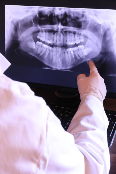 Best Cracked Tooth Emergency Dentist  in Yarrow Point, WA