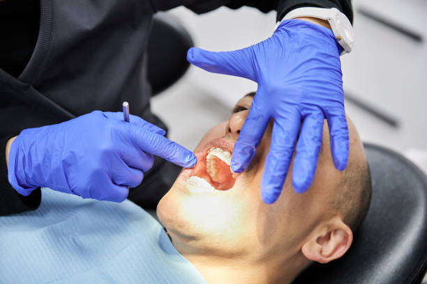 Best Urgent Tooth Repair  in Yarrow Point, WA